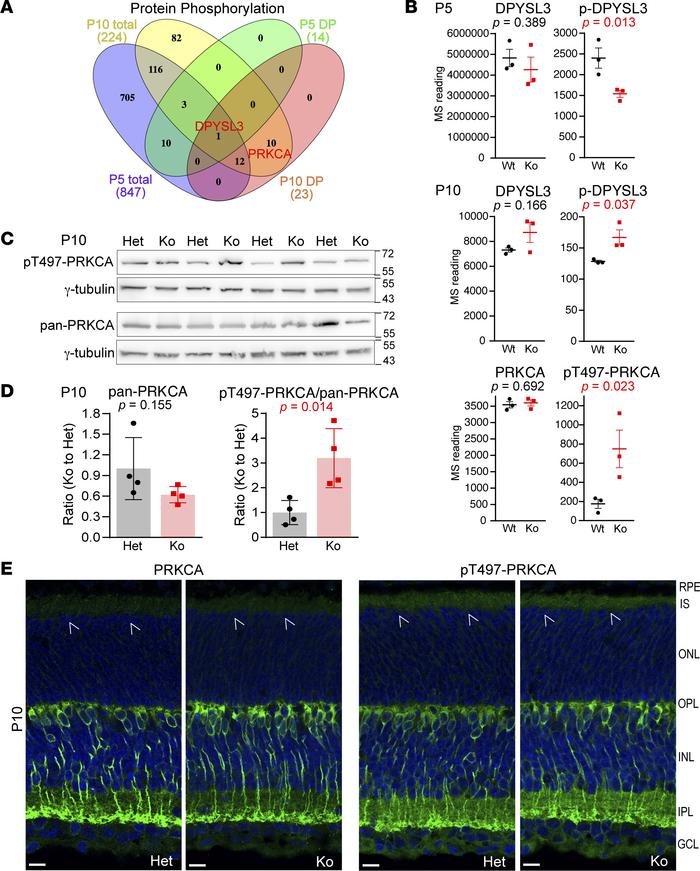 Protein phosphorylation is altered in developing Cfap418–/– photorecepto...