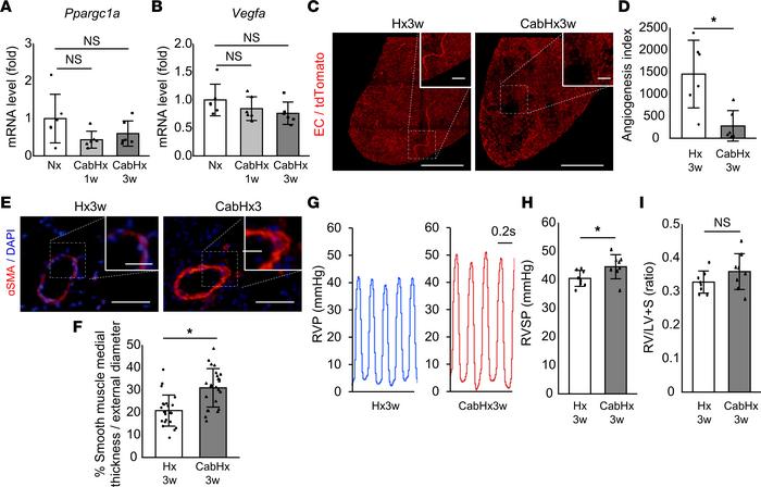 Cabozantinib, a highly potent VEGFR2 inhibitor, exacerbated Hx-PH with s...