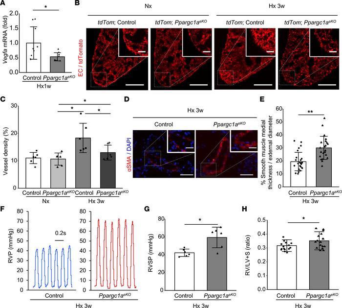 Decreased angiogenic response and deterioration of PH after Hx in EC-spe...