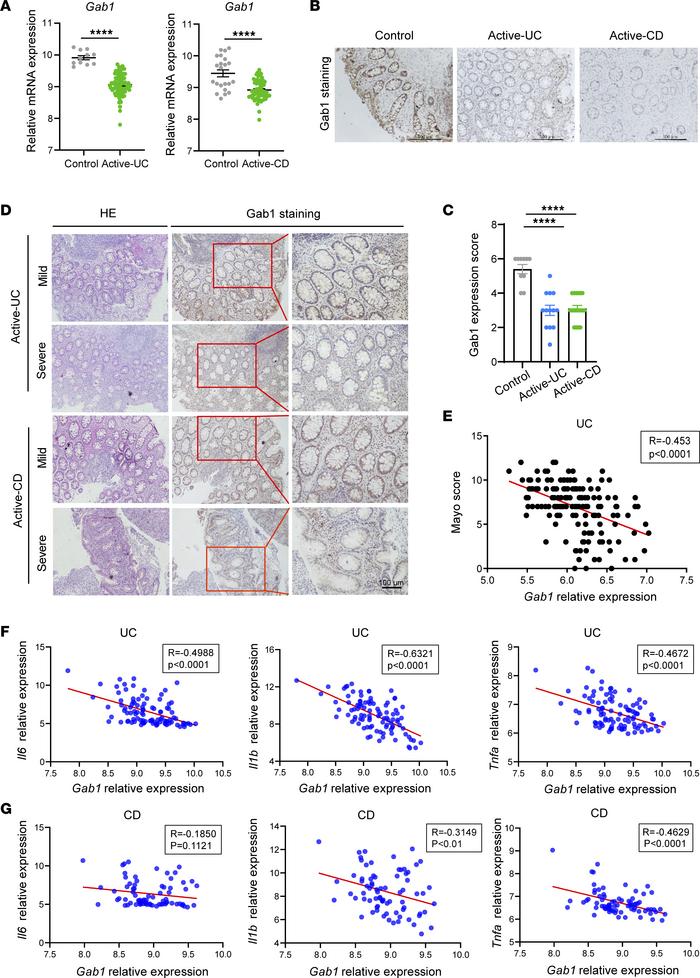 Decreased Gab1 expression in human IBD samples.
(A) Gab1 mRNA expression...