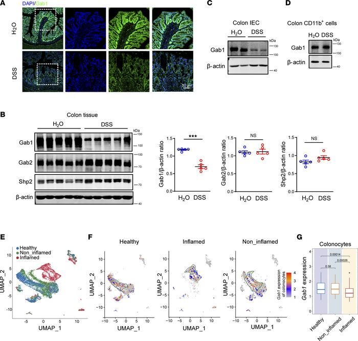 Gab1 is decreased in IECs during mouse colitis and human UC.
(A) Represe...