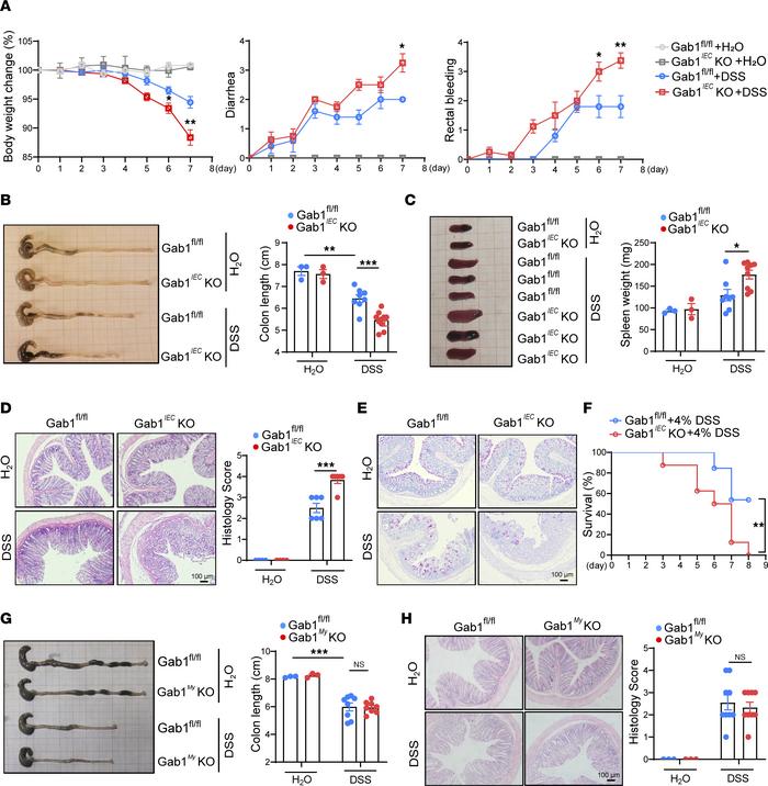 Epithelial Gab1 deficiency enhances susceptibility to DSS-induced experi...