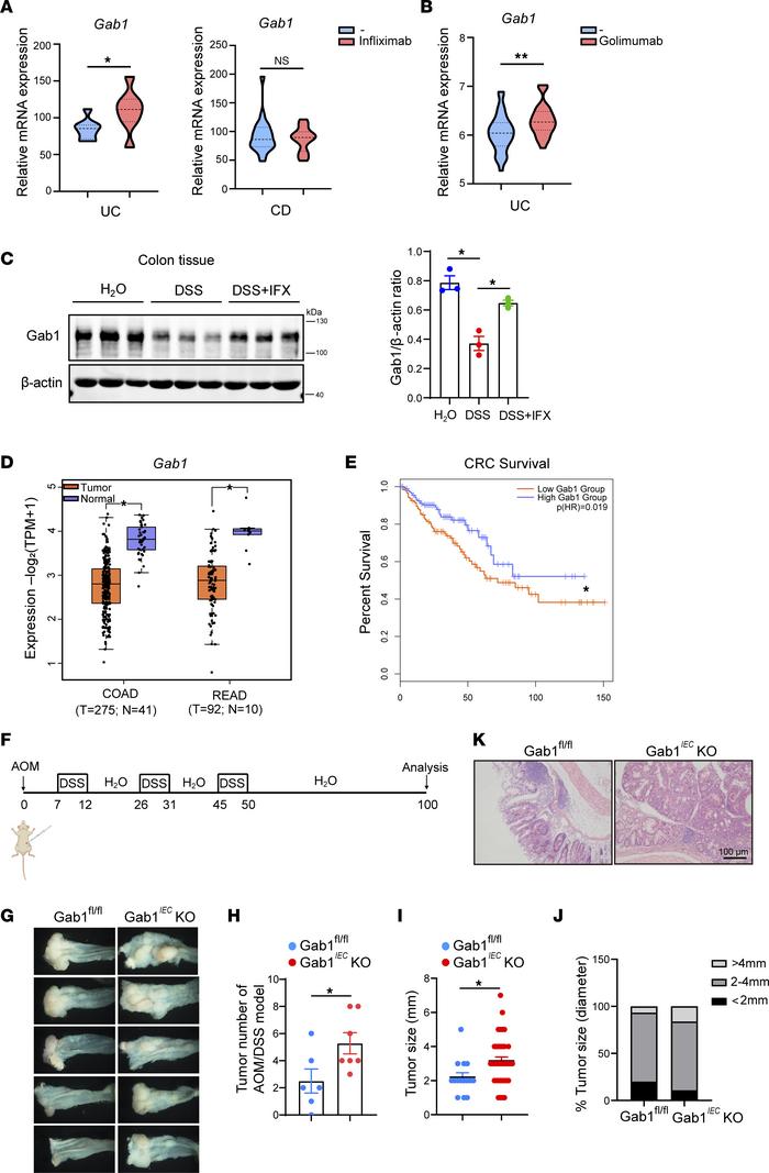 The clinical relevance of epithelial Gab1 in IBD treatment and CRC.
(A) ...