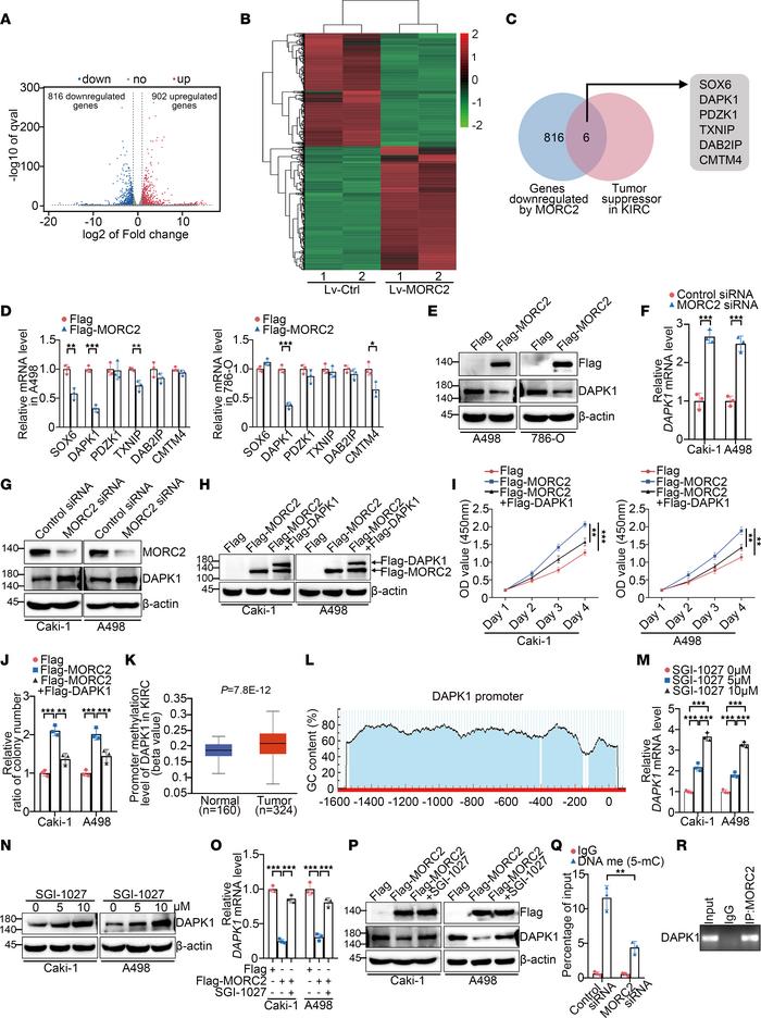 
MORC2 acts as an oncogene in KIRC mainly depending on downregulating tu...