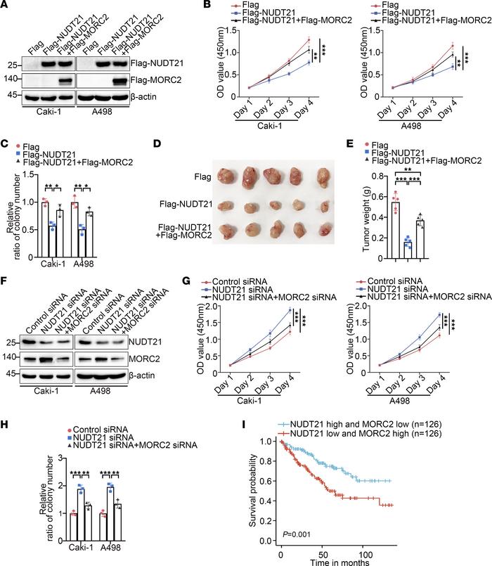 NUDT21 functions as a tumor suppressor mainly depending on MORC2 downreg...