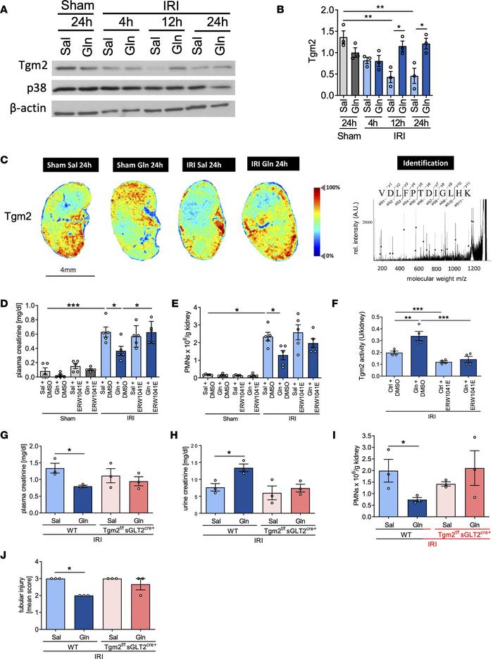 Glutamine improves kidney function upon IRI by modulating Tgm2-HSP70 int...
