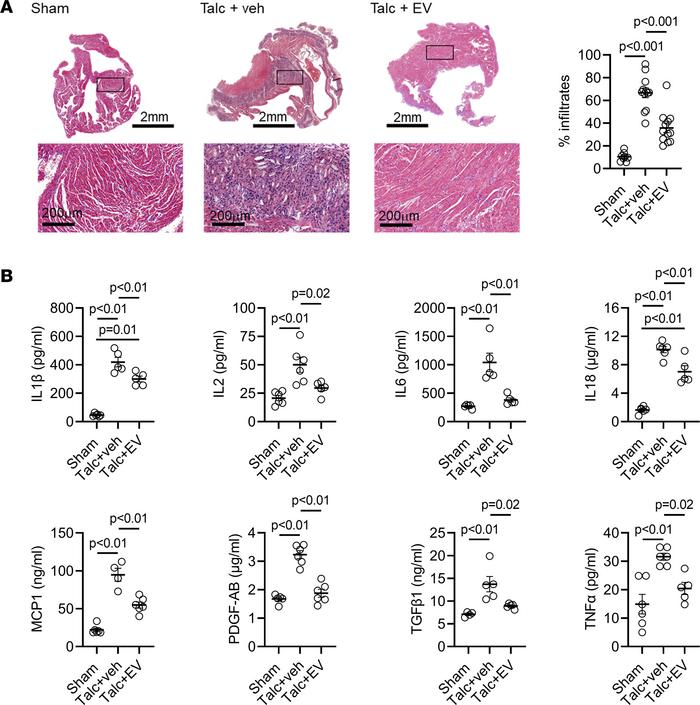 Effect of human atrial extracellular vesicles on inflammation.
(A) Repre...
