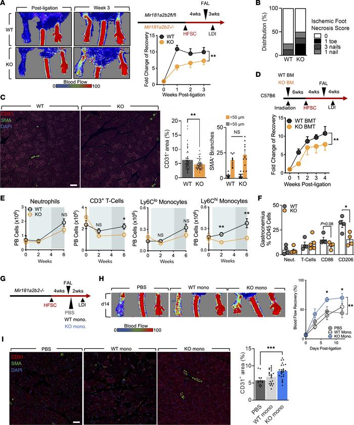 Diabetes hinders revascularization in miR-181a2b2–KO mice.
(A) Left: Rep...