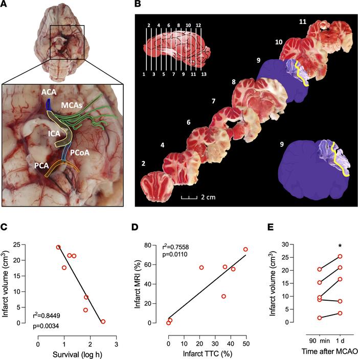 Ex vivo occlusion and brain infarct characterization, with infarct volum...