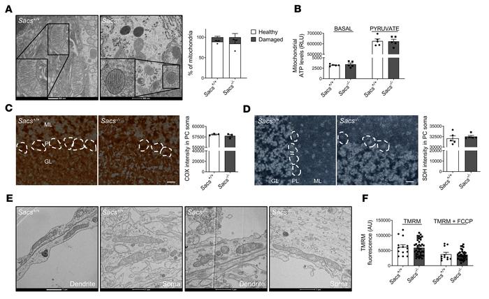 In vivo and ex vivo Sacs–/– PCs show unaltered mitochondrial ultrastruct...