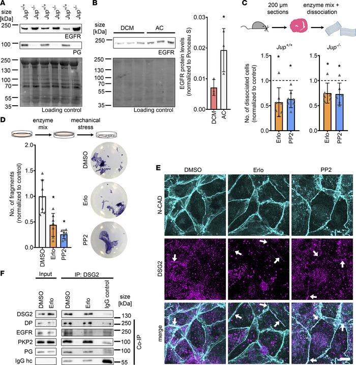 JCI Insight EGFR inhibition leads to enhanced desmosome assembly and