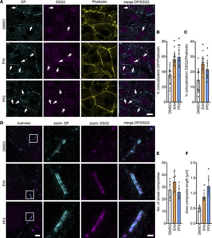 Increased DP and DSG2 recruitment to the cell membranes leads to longer ...