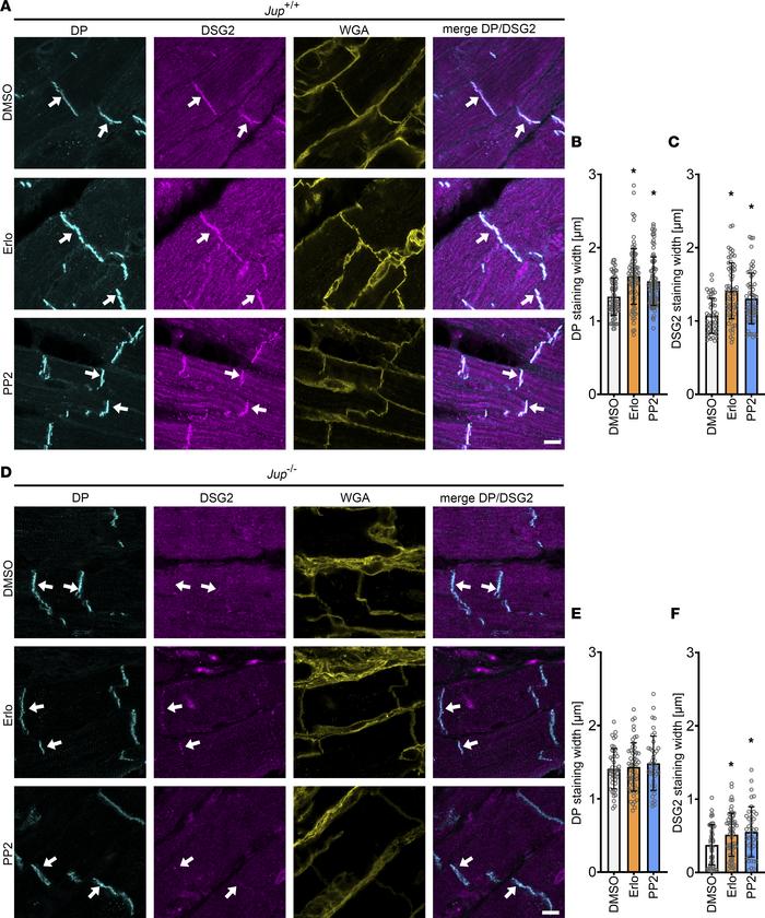 EGFR or SRC inhibition leads to increased recruitment of DP and DSG2 int...