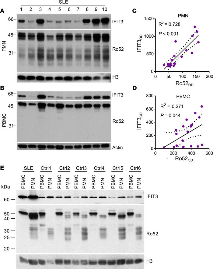 Relationship between IFIT3 and Ro52 expression in neutrophils and PBMCs ...