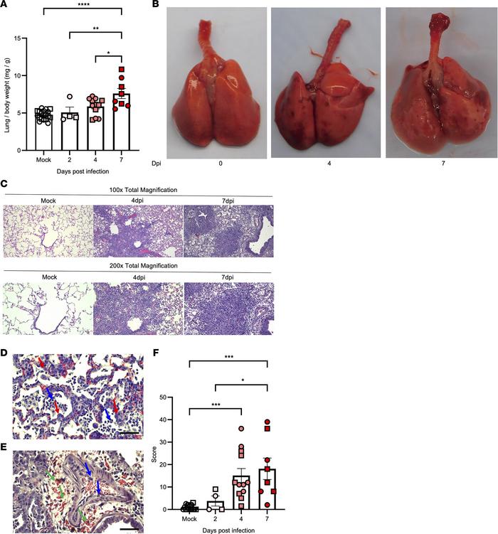 Lung injury after SARS-CoV-2 infection in hamsters.
Golden Syrian hamste...