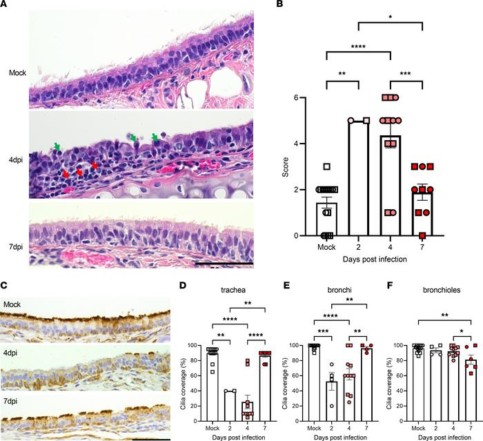 Tracheal injury after SARS-CoV-2 infection in hamsters.
After μOCT imagi...