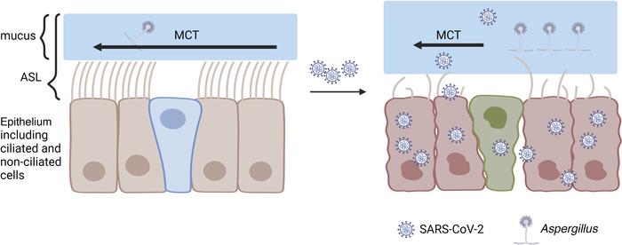 Summary of MCT pathogenesis and disease progression in hamsters.
Direct ...