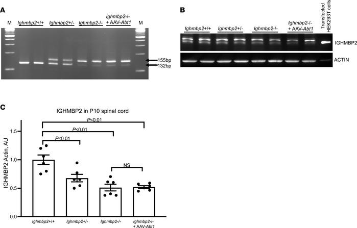 scAAV9-Abt1 delivery in Ighmbp2nmd/nmd mice does not modify Ighmbp2 spli...