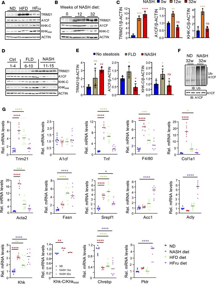 TRIM21 expression is induced in steatohepatitis.
(A and B) Western blots...