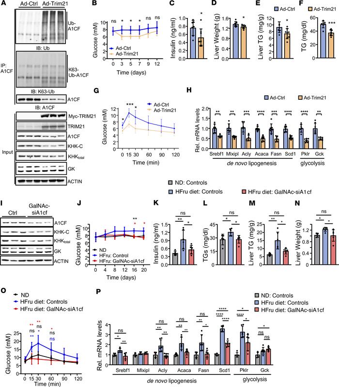 Hepatic TRIM21 protects from fructose-induced steatosis via degradation ...