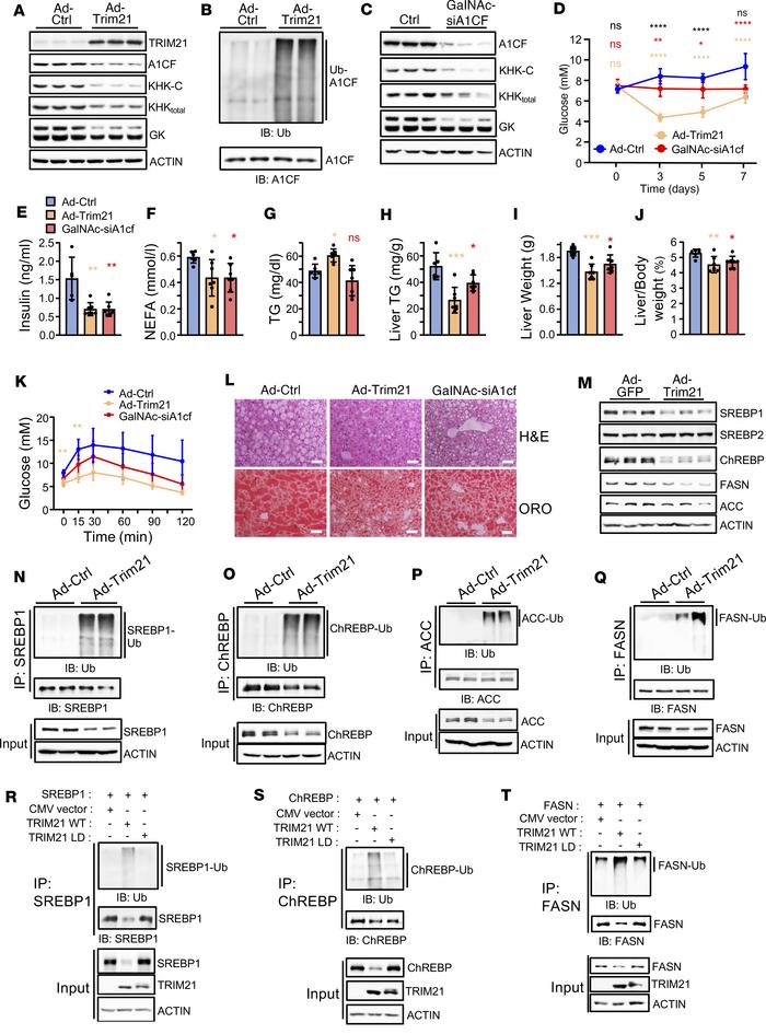 TRIM21 improves steatosis in NASH through inhibition of de novo lipogene...