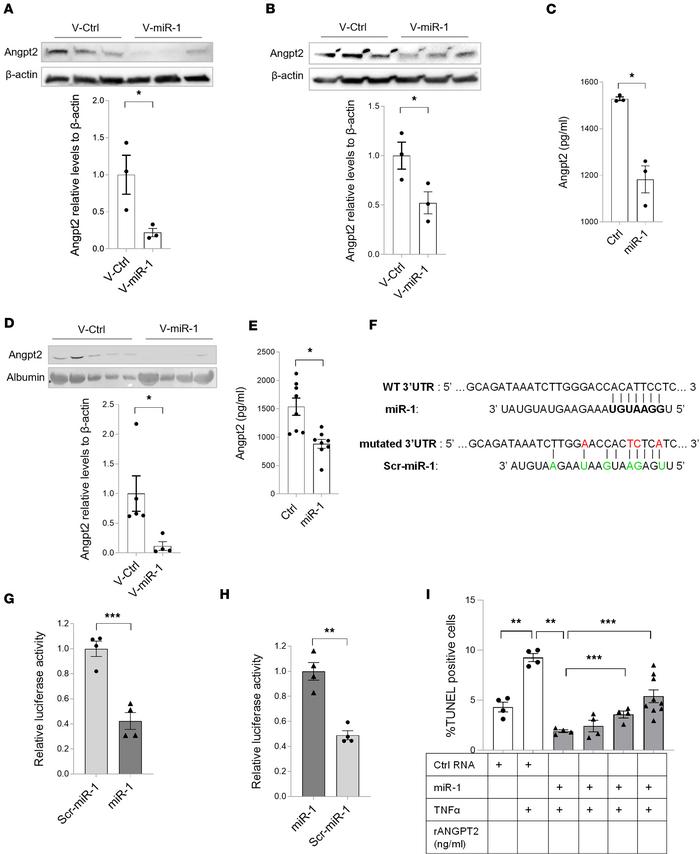 miR-1/ANGPT2 axis.
(A and B) Endothelial cells were transduced with V-mi...