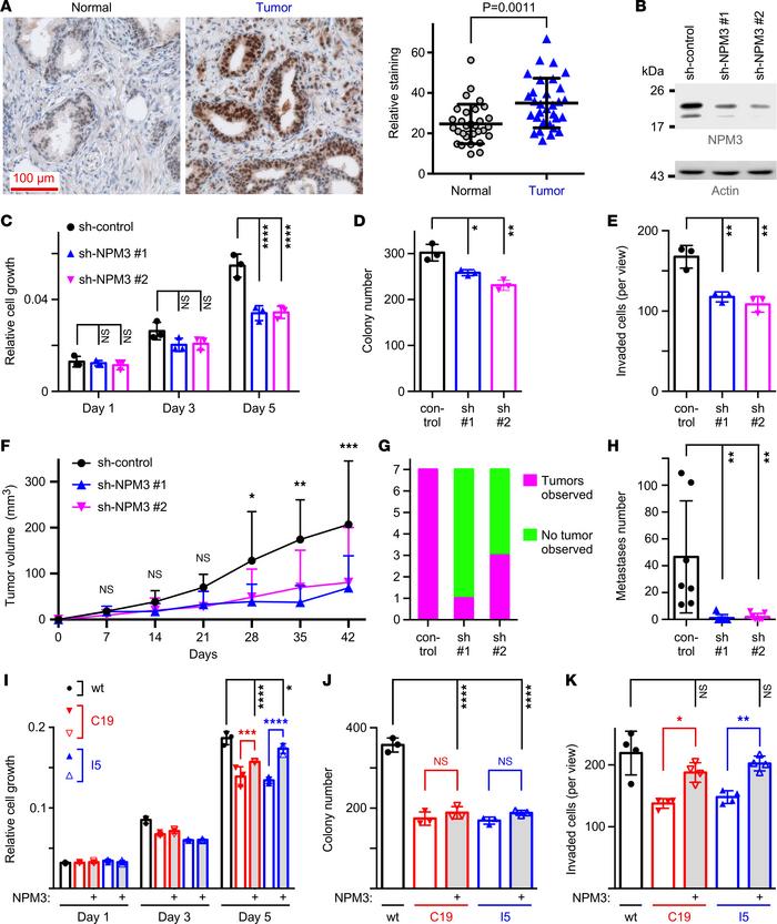 Oncogenic properties of NPM3.
(A) Example of NPM3 immunoreactivity in no...