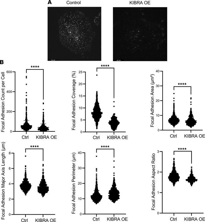 KIBRA overexpression reduces expression and alters parameters of podocyt...