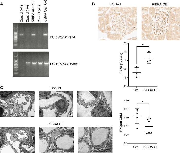 Podocyte-specific overexpression of KIBRA increases susceptibility to ac...