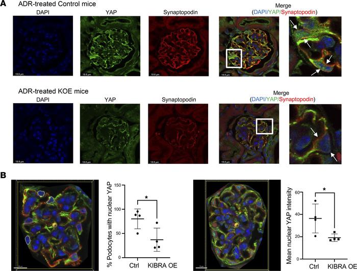 YAP localization in ADR-treated mice.
(A) ADR-treated KIBRA-OE mice show...
