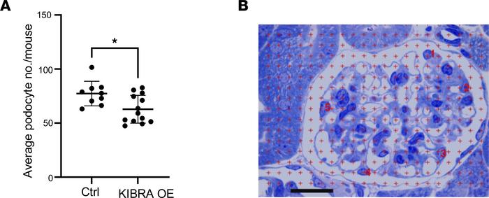 Podocyte number in ADR-treated mice.
(A) ADR-treated KIBRA-OE mice show ...