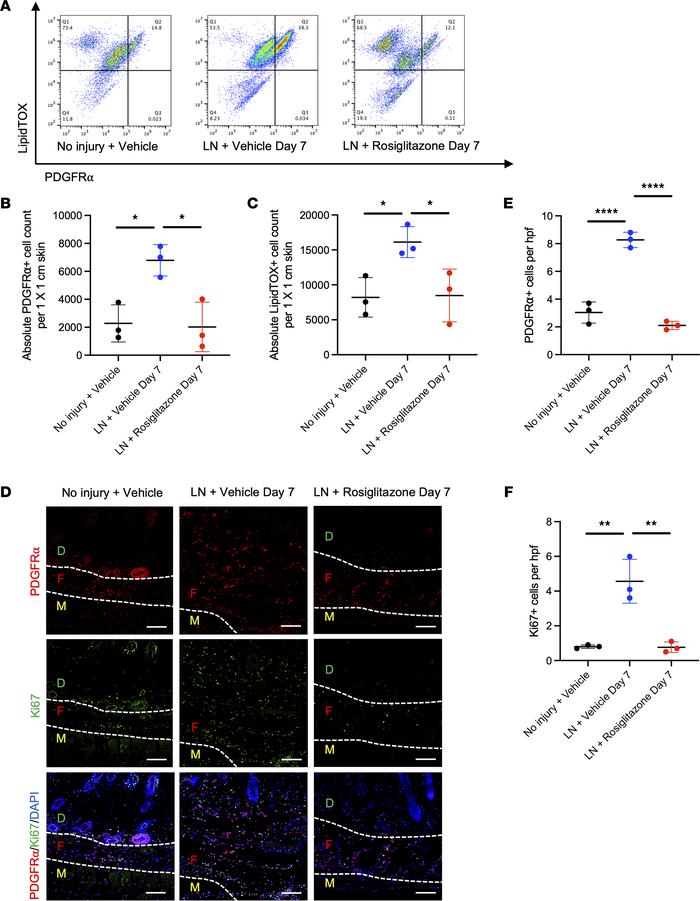 Rosiglitazone reduces presence of PDGFRα+ adipocytes after lymphadenecto...