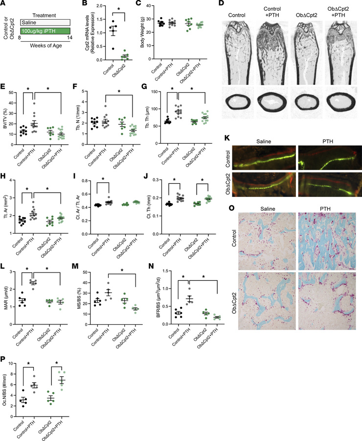 Fatty acid oxidation is required for iPTH-induced anabolism.
(A) Depicti...