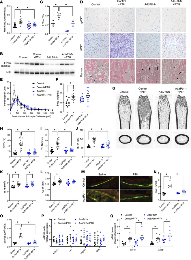 iPTH signals in adipose tissue to regulate bone formation.
(A) Serum fre...