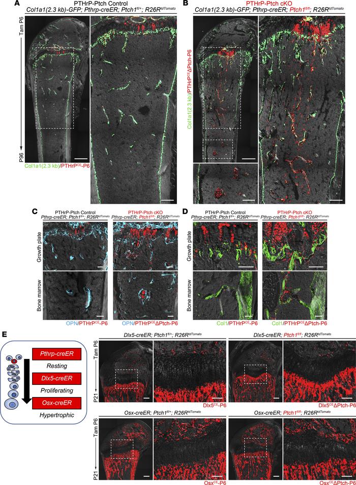 Hedgehog-activated PTHrP+ descendants transform into trabecular bone ost...