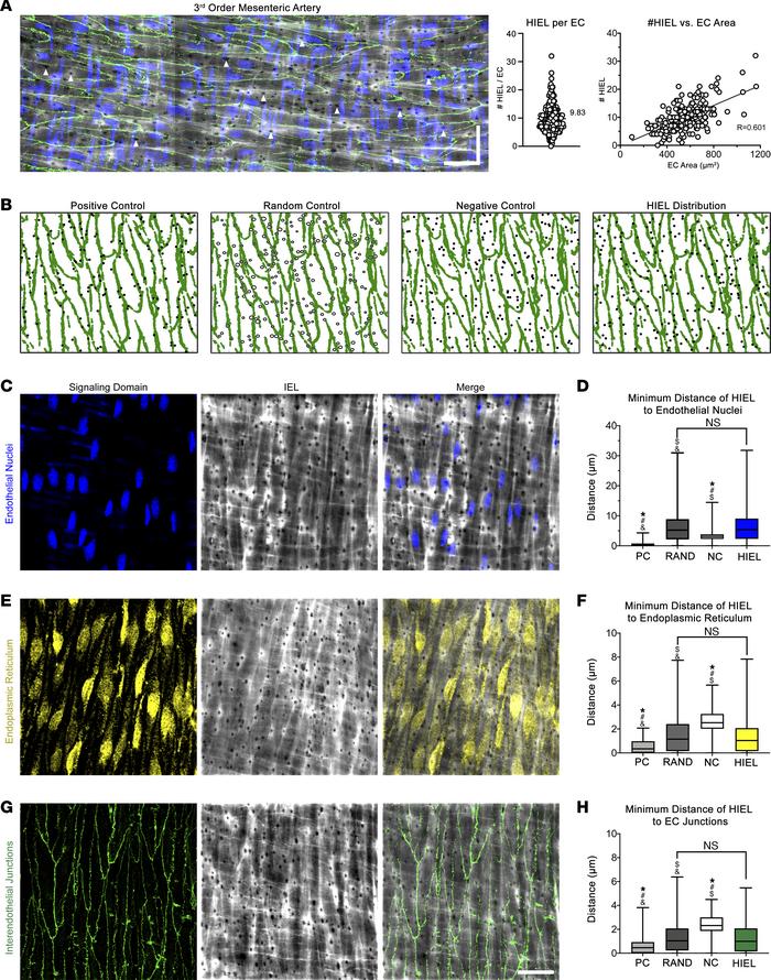 HIEL are randomly distributed with respect to endothelial signaling hubs...