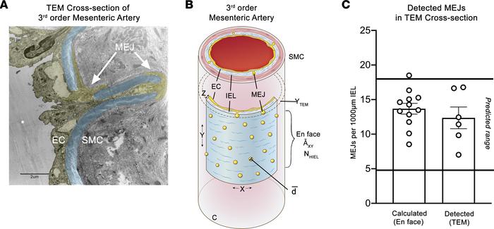 Every HIEL contains an MEJ.
(A) Transmission electron microscopy (TEM) i...