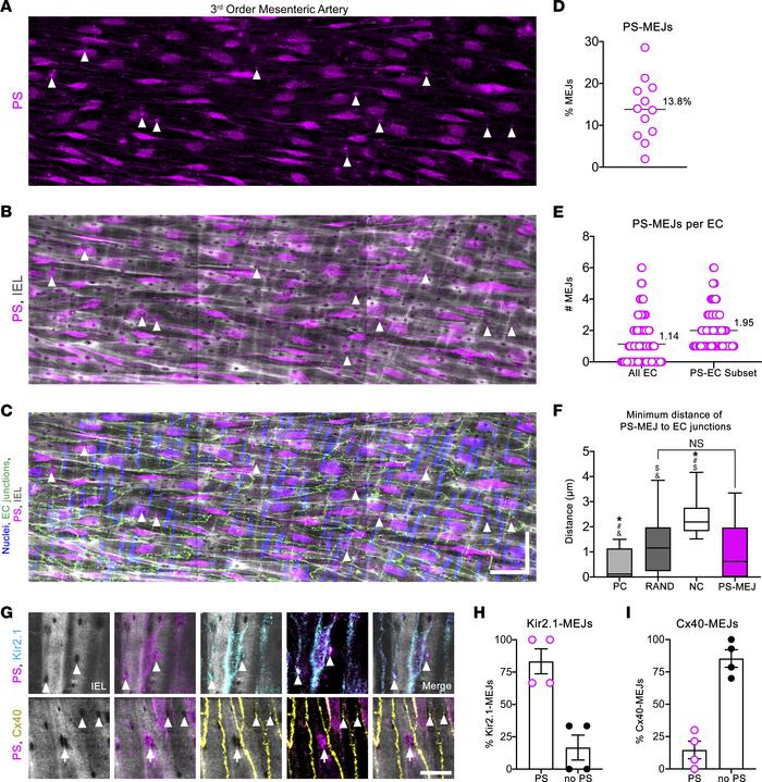 PS colocalizes with Kir2.1 in a subpopulation of MEJs.
(A–C) Representat...