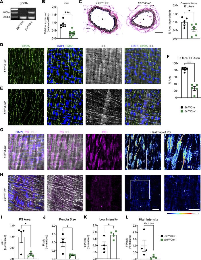 
Elnfl/fl/Cre+ mice have disrupted PS localization in endothelium.
(A) G...