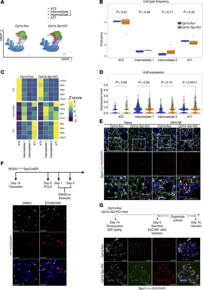 
Cpt1a deficiency in AT2 cells induces the emergence of cells in an ADI ...