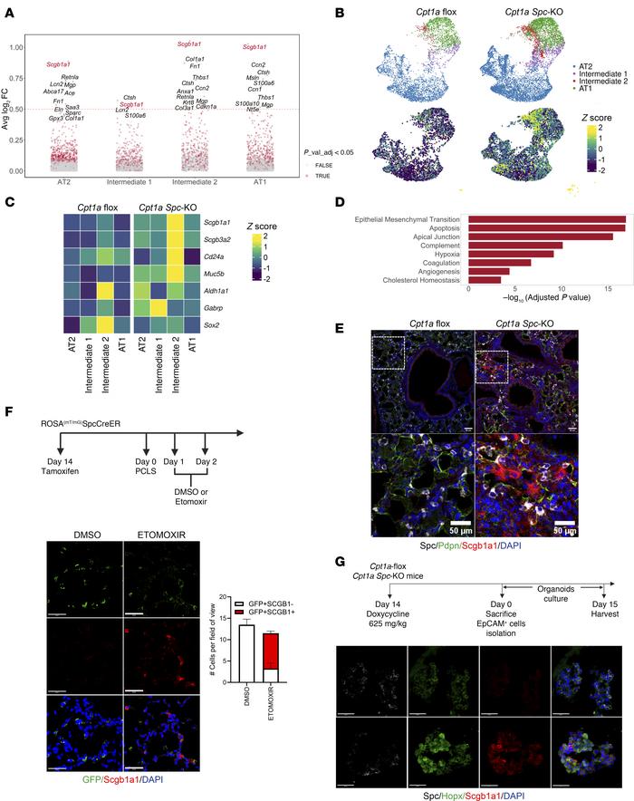 
Cpt1a deficiency promotes a RAS intermediate phenotype.
(A) Upregulated...