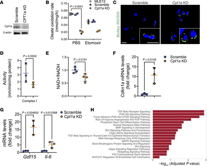 
Cpt1a deficiency induces mitochondrial dysfunction.
(A) Representative ...