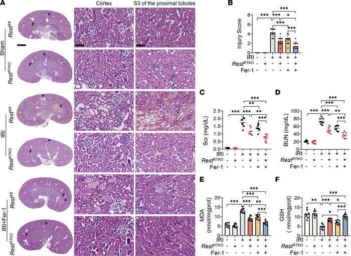 Renal tubule–specific knockout of Rest alleviates lipid peroxidation in ...