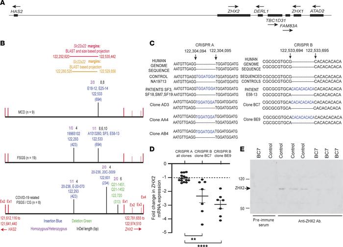 Insertions and deletions in noncoding DNA affect ZHX2 expression in pati...