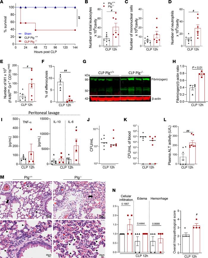 Assessment of survival rates and inflammatory parameters in Plg–/– mice ...