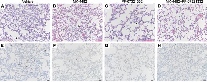 Combination therapy reduces lung pathology and SARS-CoV-2 antigen load i...