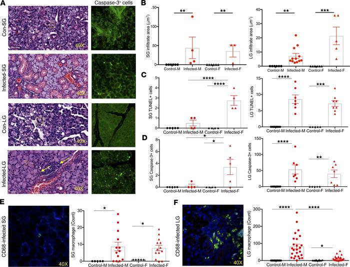 Increase in inflammation and apoptosis detected in SGs and LGs of infect...