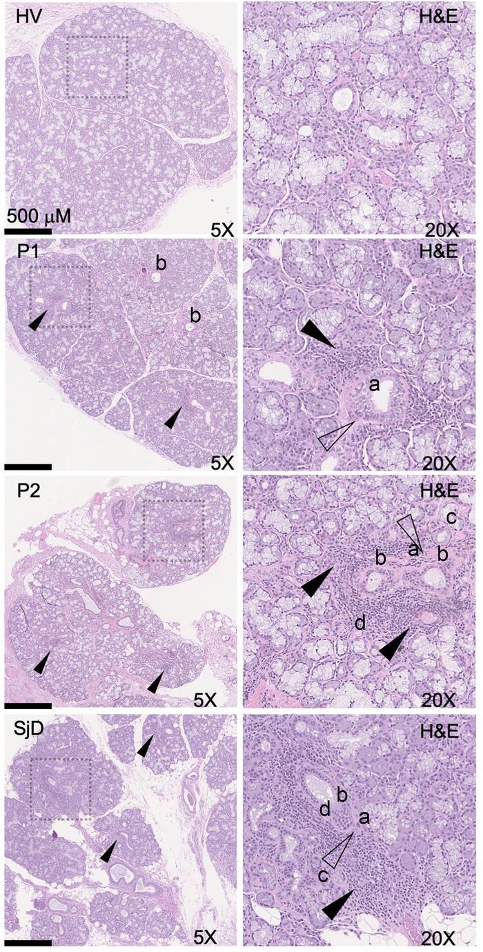 Representative MSG H&amp;E photomicrographs of HCs, SjD, and 2 represent...