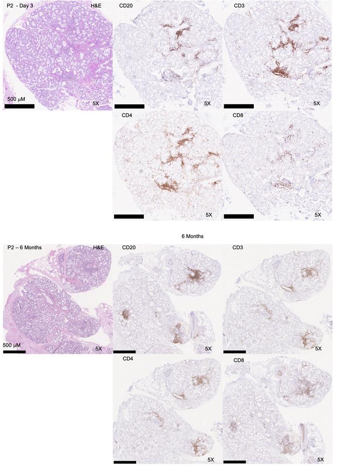 Immunophenotyping of acute and postacute COVID-19 infection.
Representat...