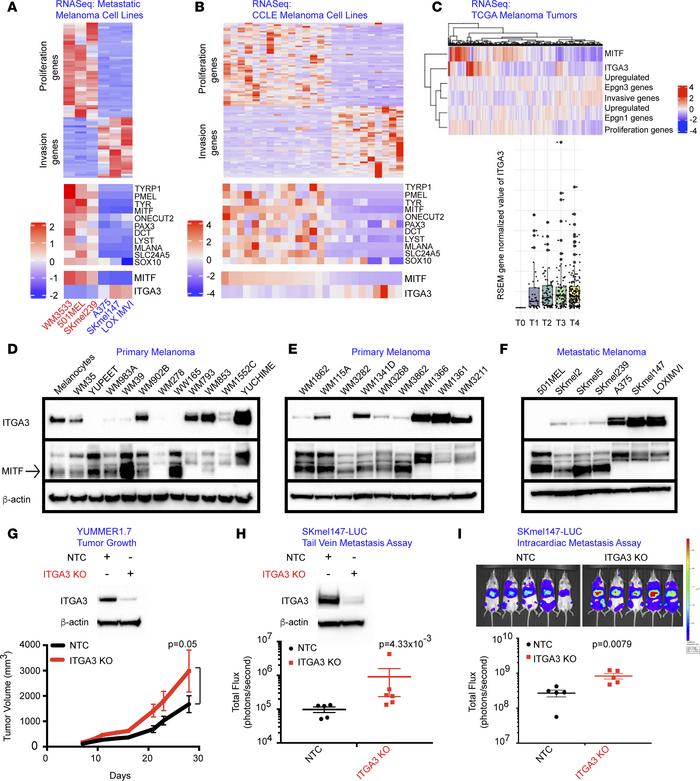ITGA3 is overexpressed in Epgn3 high-risk melanomas and negatively regul...